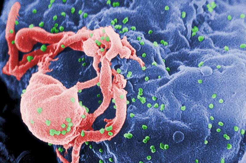 HIV Virus (Illustration)