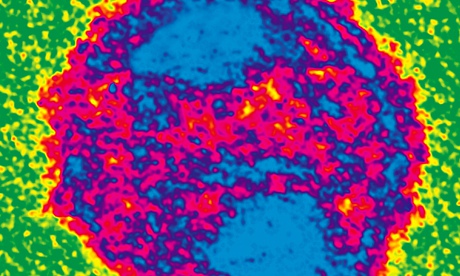 Drug treatment, now reaching nearly 13 million people, has stabilised the Aids ­epidemic in most countries, but it is expensive, and may be unsustainable. Photograph: Deco/Alamy