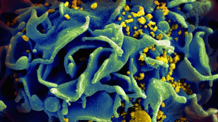 HIV-infected T cell. (NIAID)
